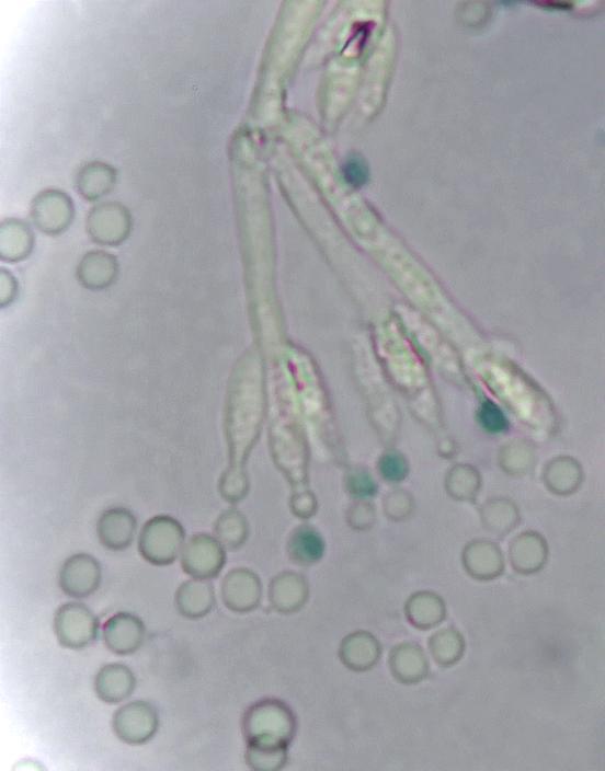 Bild 2: Penicillium corylophilum