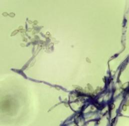 Bild 1: Außenluftpilz Cladosporium sp.